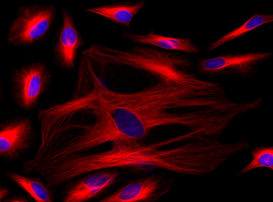 figure-for-readilink-xtra-rapid-cy5-antibody-labeling-kit-bsa-compatible_uZYAR.jpg